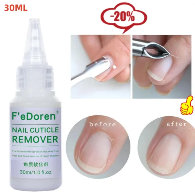 30 ml removedor de cutículas gel crema para uñas muerta suavizante profesional para uñas herramienta-