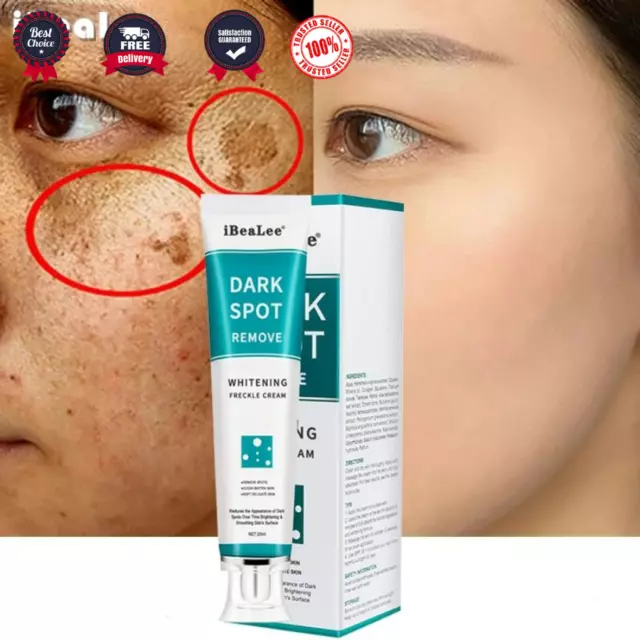 Strong Removal Melasma Whitening Cream Freckle Speckle Spots Melanin Pigment