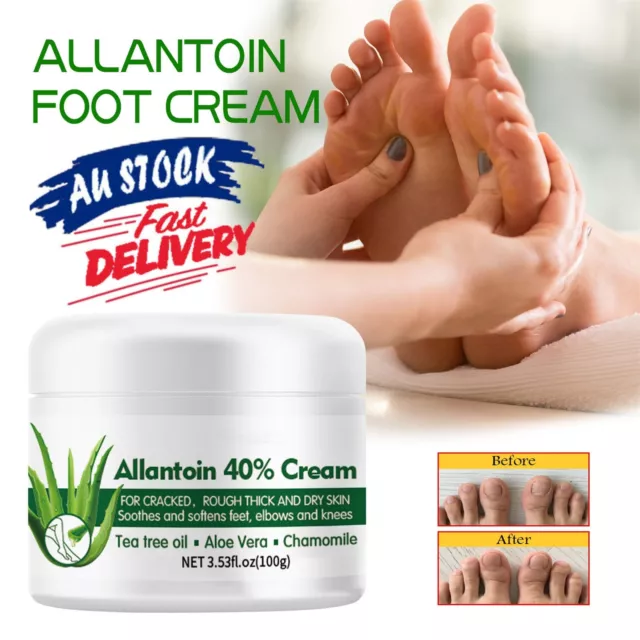 Foot Skin Care Cracked Heel Balm Cream For Rough Dry Feet Skin Moisturizing