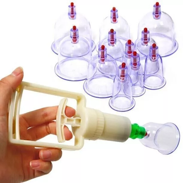 Schröpfen Set Mit 12tlg Schröpfgläser Cupping Schröpfset Vakuum Massage DE ~