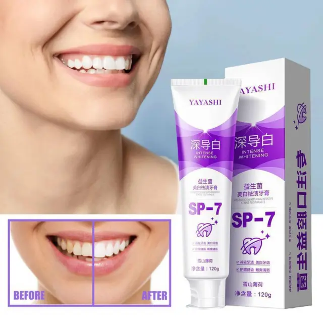 120g SP-7 Probiotic Whitening Toothpaste Color Corrector Tooth Stain M1A0