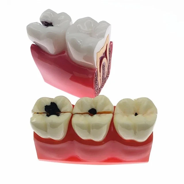 Tipodonti dentali - Distributore di materiale odontoiatrico