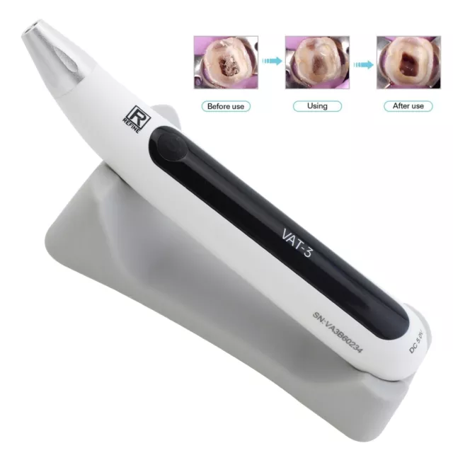 Refine Dental Endo Activator Ultrasonic Cordless Irrigator Root Canal Handpiece