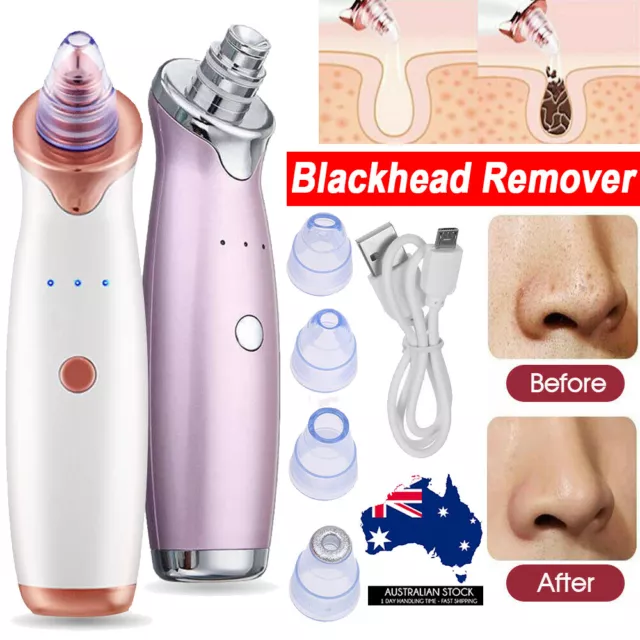 Face Facial Pore Blackhead Remover Vacuum Suction Diamond MN