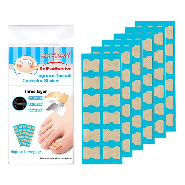 Autocollants de correction d'ongle incarné, patch élastique pour ongles