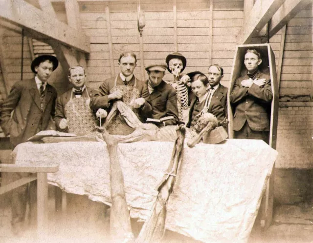 Antique Medical Autopsy Photo 749b Oddleys Strange & Bizarre