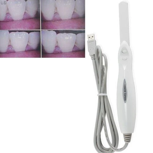 Dental  Intraoral Camera Compatible with Windows XP /Windows Vista/Windows 7