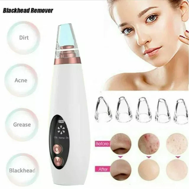 Pulitore acne punti neri detergente pelle viso macchina rimozione punti neri