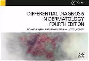 Differential Diagnosis in - Paperback, by Ashton Richard Leppard - Very Good