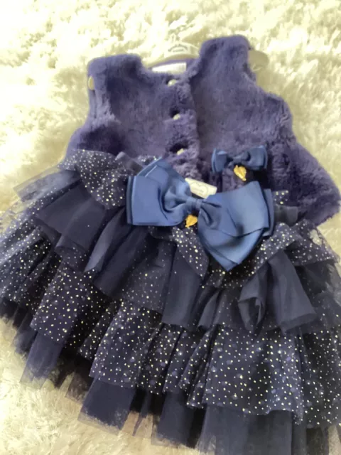 Angel face girls bundle. Adorable fur gillet and beautiful tutu skirt.
