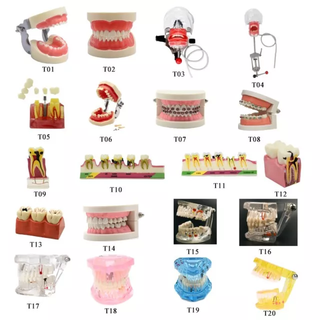 Dental Typodont Teeth Model Ortho Implant Pathological Perio Practice Demo Model