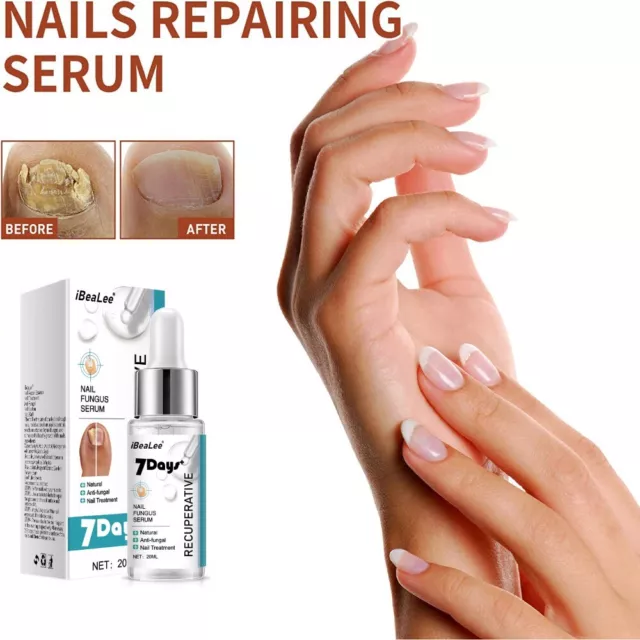 mains Traitement des ongles Sérum de réparation Anti-infectieux Sérum Essence