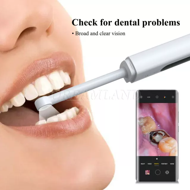 Caméra intrabuccale dentaire Endoscope Wifi sans fil Image claire Type-C 2