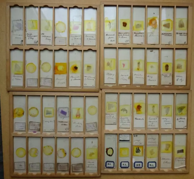 144 Vintage Medical Microscope Slides in Case (Damaged)