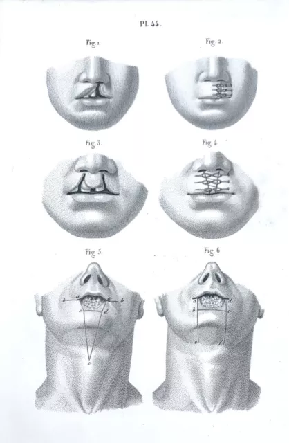 Anatomische Zeichnung: Huette E. Bernard, ca. 1850