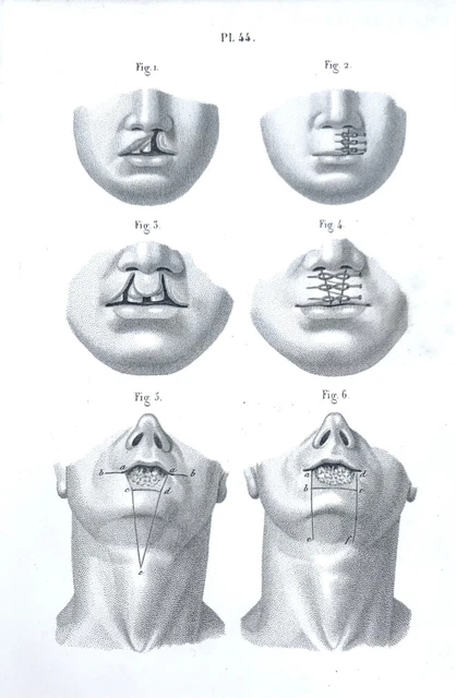 Anatomische Zeichnung: Huette E. Bernard, ca. 1850