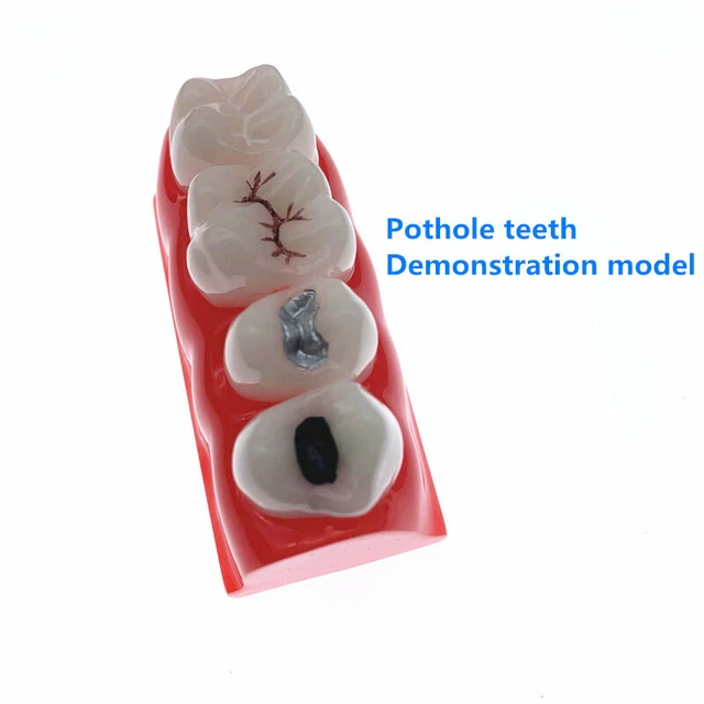 Dental Teeth Model - Alta Dental Solution