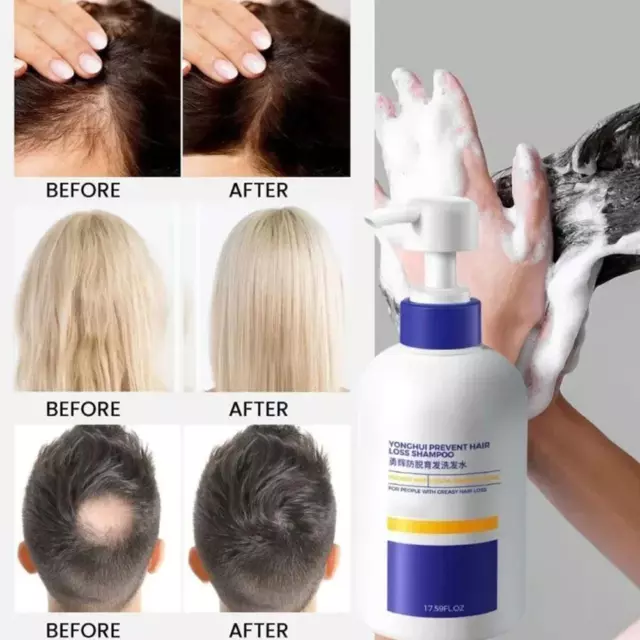 Anti-Growth Hair Shampoo Nourishing Soft Fluffy Repair Roots Growth Strengthens`