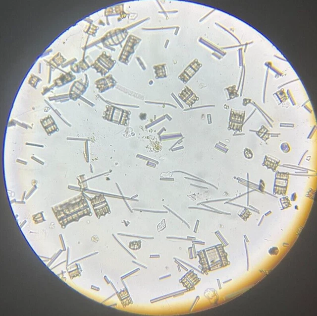 J.D. Moller Microscope Slide Diatom Island of Tongataboo Slime Gold Medal 1869
