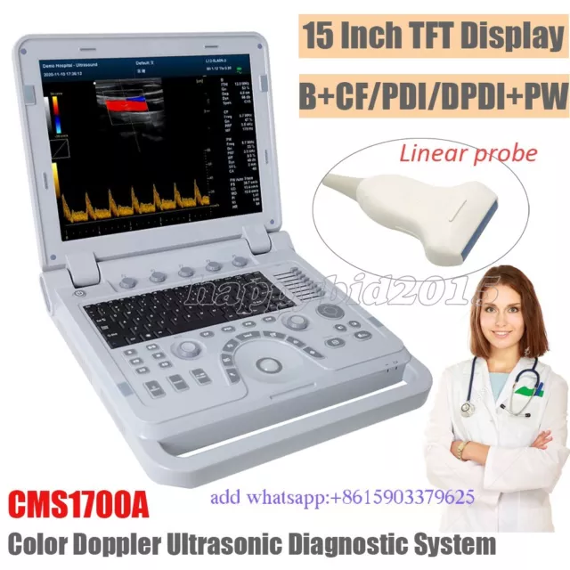 Sonde linéaire de scanner d'ultrason de CF de diagnostic ultrasonique de Doppler