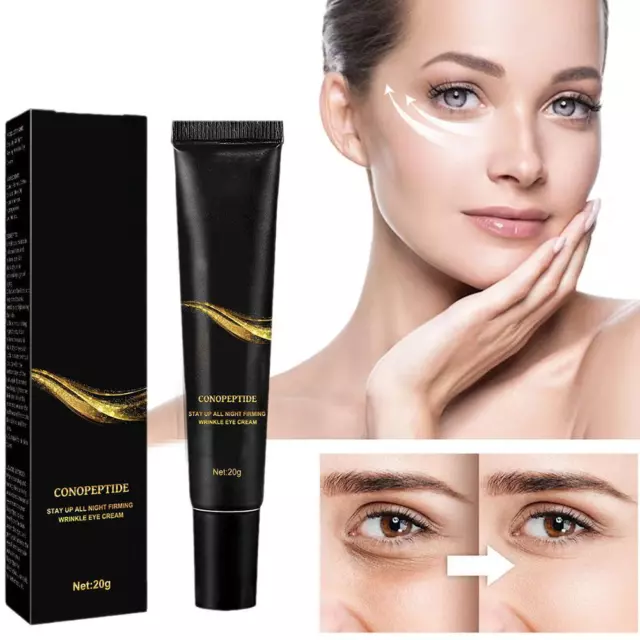 Best Eye Bag Cream,Temporary Eye Tightener Eye Cream Reduce Wrinkles J5U0