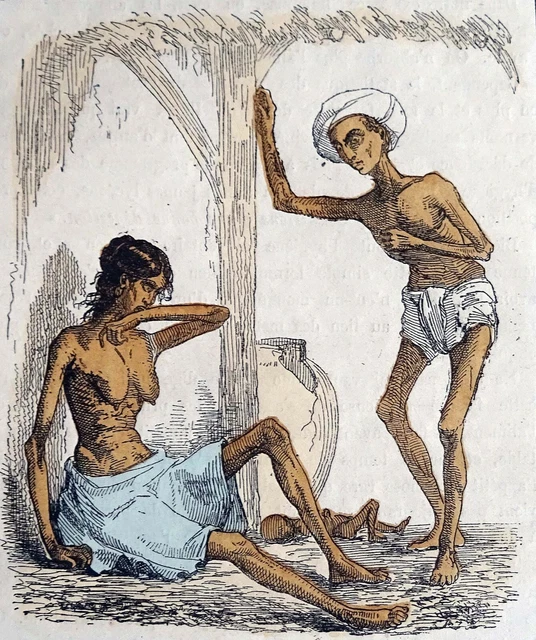 MÉDECINE - EFFETS de la FAIM en INDE au 19e siècle -  Gravure du 19e siècle