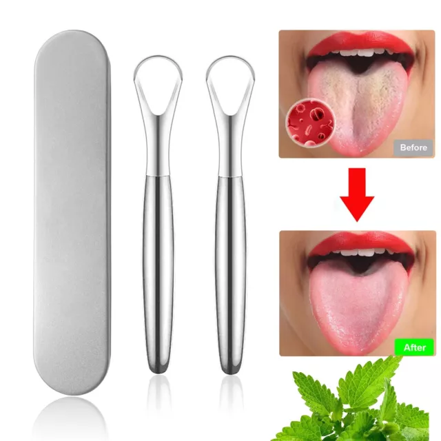 2Pack Tongue Scraper Cleaner for Adults  Fights Bad Breath 100% Stainless Steel