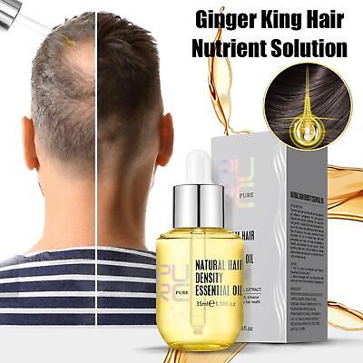 Producto de crecimiento del cabello esencia de jengibre aceite de crecimiento rápido suero pérdida de cabello medicamento K3