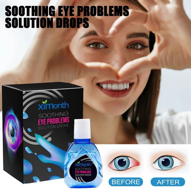 Soothing Eye Drops, Eye Care Brightening Solution 10ml O5R0