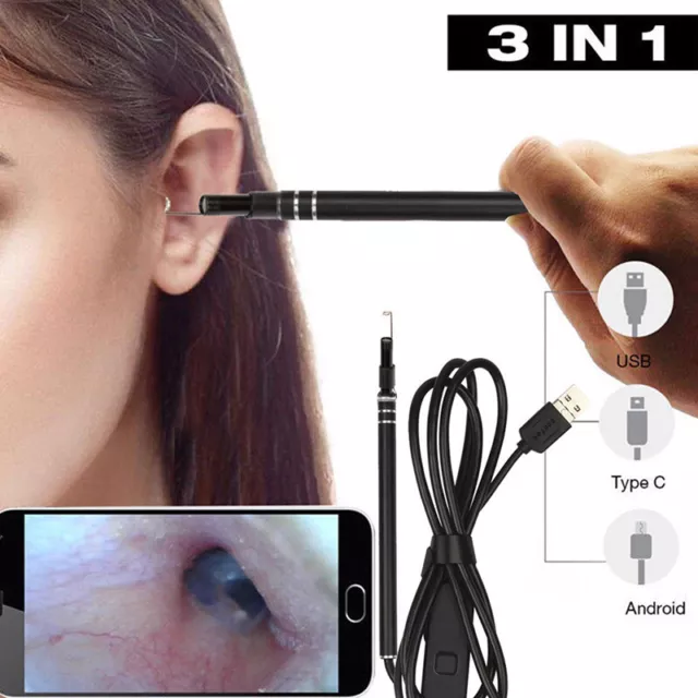 Digital Led Otoscope Ear Camera Scope Earwax Removal Kit Ear Wax Cleaning Too $d 2