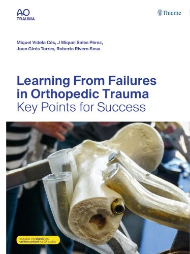LEARNING FROM FAILURES in Orthopedic Trauma: Key Points for Success ...