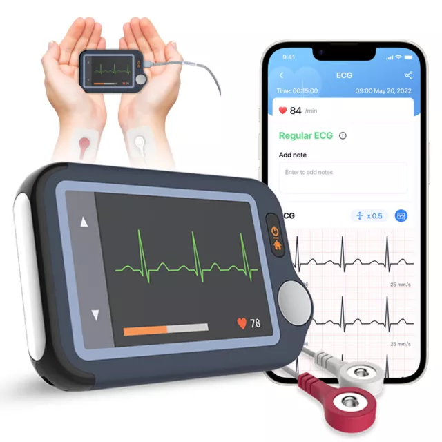 Geräusch freier EKG Gerät mit externem Kabel 30s / 60s / 5min Aufnahme Über App