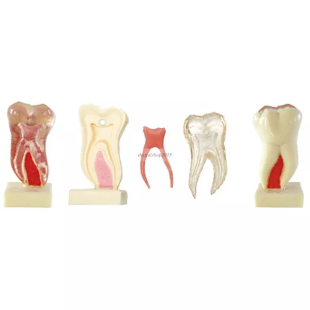 1pc dental 6 Times Anatomic Profile Model of Mandibular Molar study model