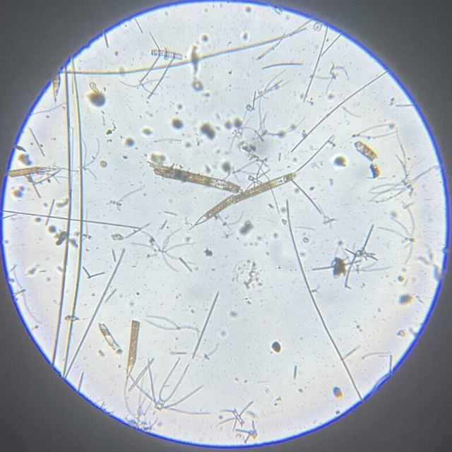 J.D. Moller Microscope Slide Diatom of the Atlantic Ocean Gold Medal 1869