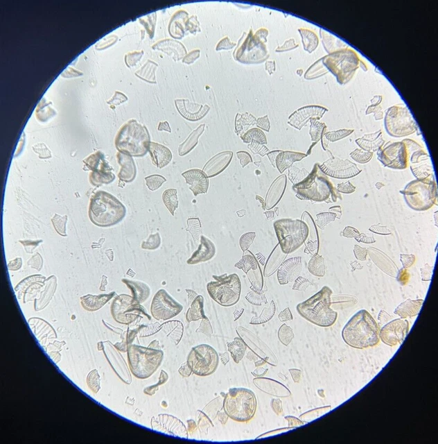 J.D. Moller Microscope Slide Diatom Fossil Christiansstadt Earth Sweden 1869