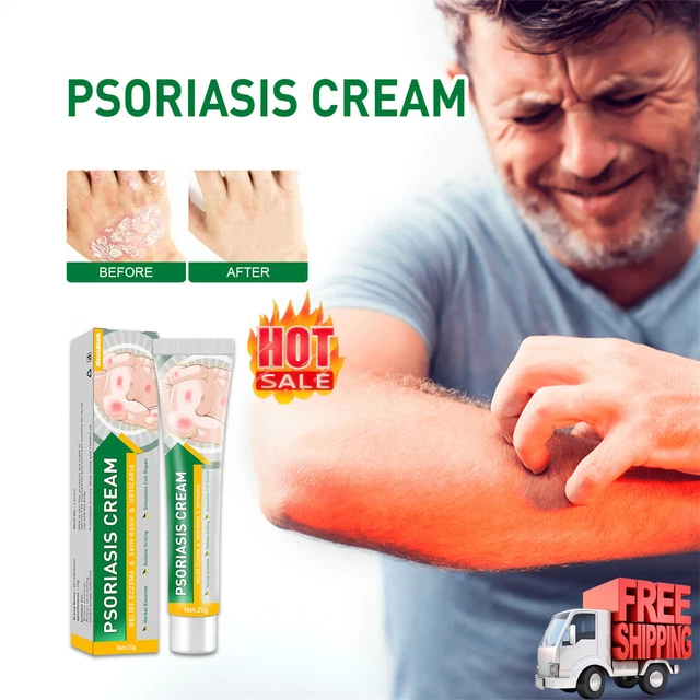 PSORIASIS CREAM DERMATITIS Eczematoid Ointment Scalp Fungus Skin Care