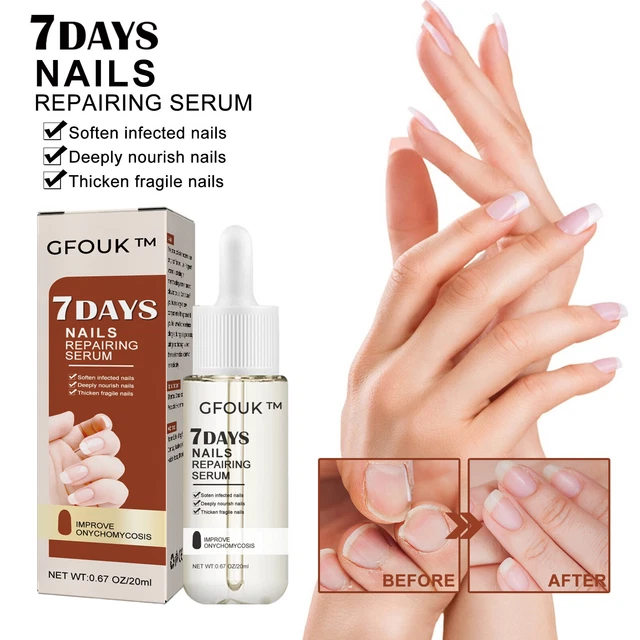 20 ml 7 días crecimiento y fortalecimiento de uñas crecimiento y fuerza Uñas Repairi