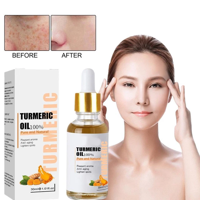 Olio di siero di curcuma viso sbiancante ance correttore di macchie trattamento macchie scure