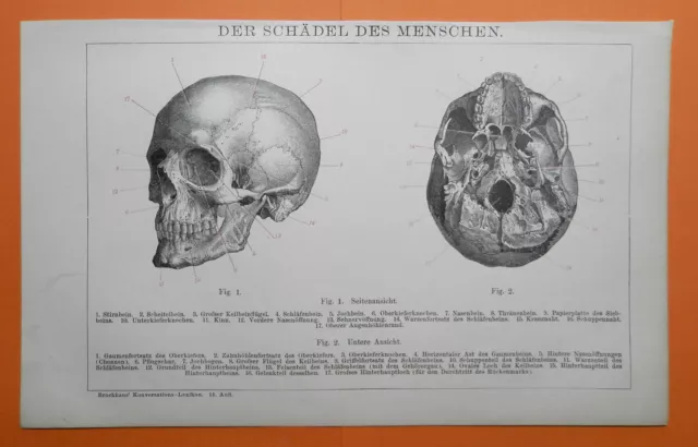 Schädel des Menschen Stirnbein Schläfenbein Jochbein   LITHOGRAPHIE von 1895