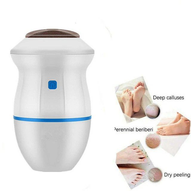 Strumento di rimozione cornea elettrica con rimozione sottovuoto pedicure lima piede