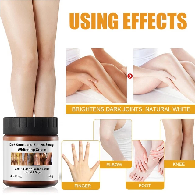 Crema reparadora aclaradora de rodilla 120 g crema blanqueadora de piel oscura