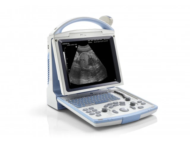 Mindray DP-10 2013 Ultrasound with Mindray 35C50EB Convex Transducer
