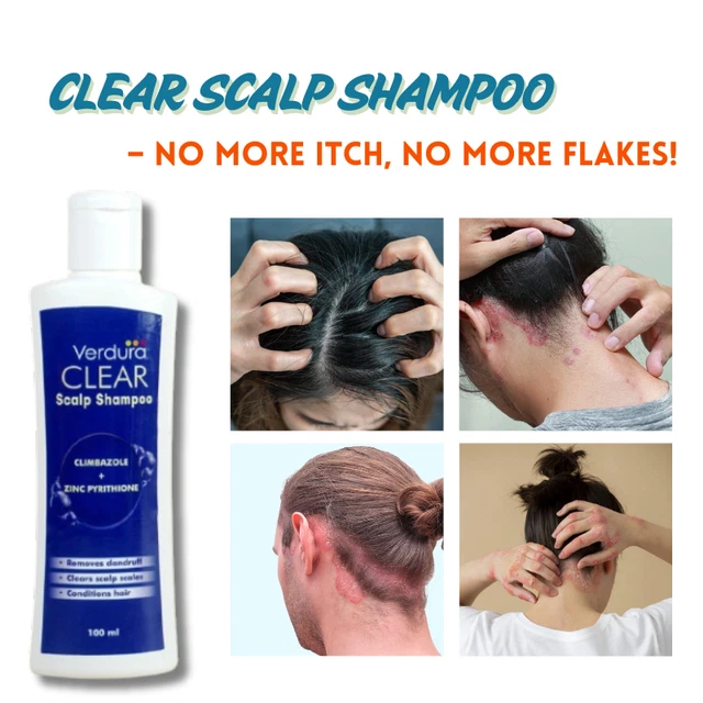 ANTI SCALING SCALP Shampoo Dry Scalp Dandruff Medicated Shampoo 200ml £ ...