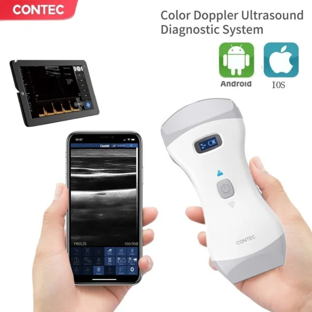 https://www.picclickimg.com/CvEAAOSwgDlkq8EZ/Portable-Wireless-Ultrasound-Scanner-Color-Doppler-Machine-Convex.webp