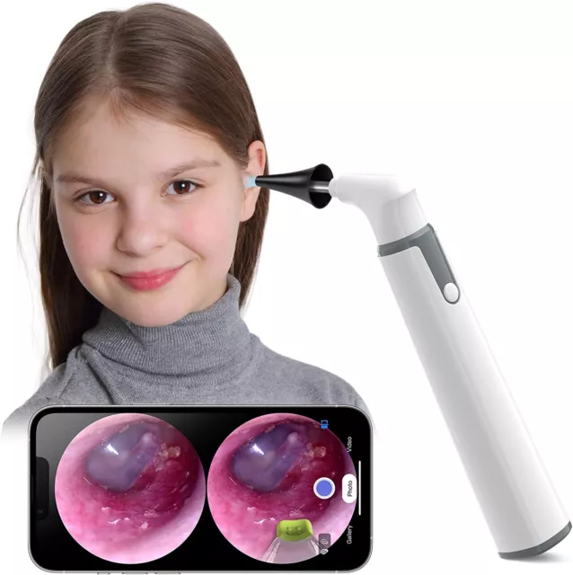 Kit de limpieza de cera para oídos ScopeAround SA39W endoscopio otoscopio de doble vista