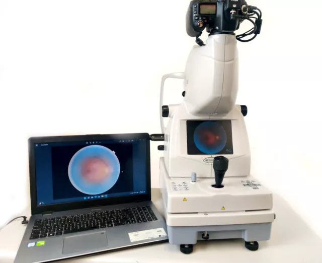 Topcon TRC NW8 Non-mydriatic Fundus Retinal W/ Nikon D7500 & Table. Functional