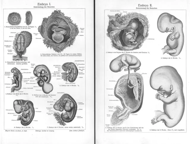 Embryo Entwicklung des Menschen Uterus Nabelschnur Fruchtblase Arzt  Stich 1906