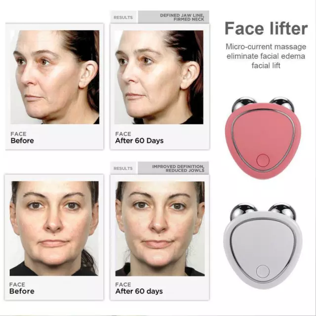 Massaggiatore Microcorrente Face Lift Rullo Macchina NUOVO Q9V0