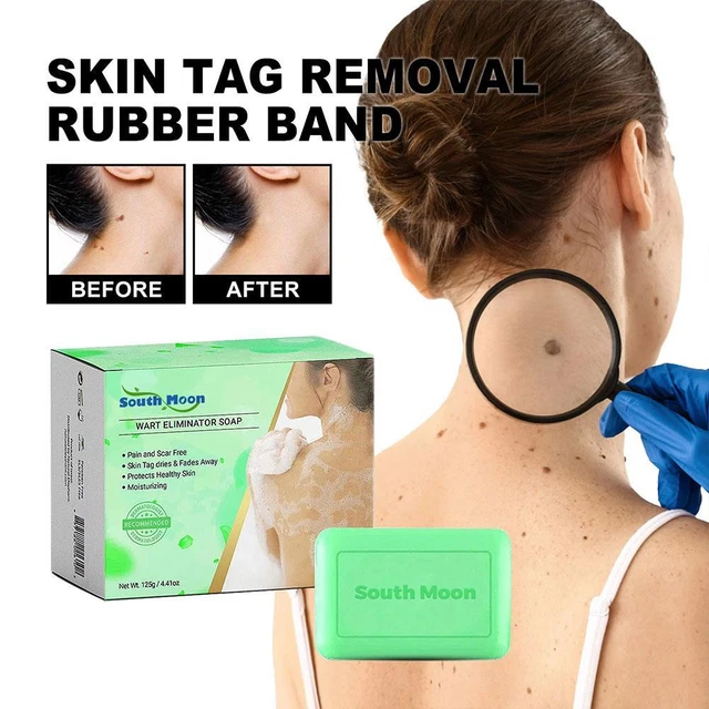 Jabón eliminador de verrugas SmoothSkin jabón eliminación de verrugas