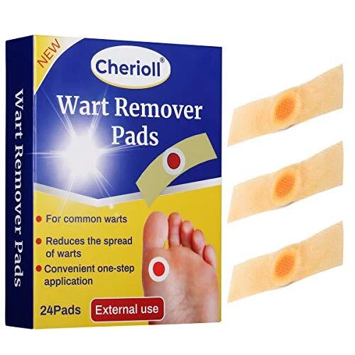 Verrue, Acrochordons Traitement, Anti Verrue, Zero Verrue, Homéopathie Verrue, T